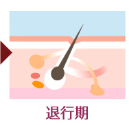 退行期