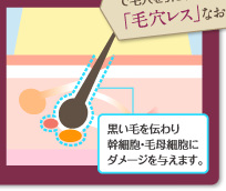 黒い毛を伝わり幹細胞・毛母細胞にダメージを与えます。